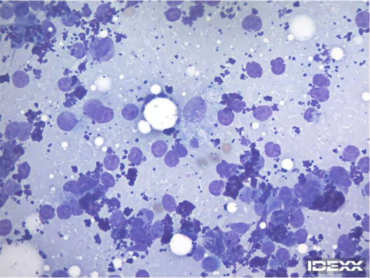 Figure 2. Lymph node cytology. 100x objective.