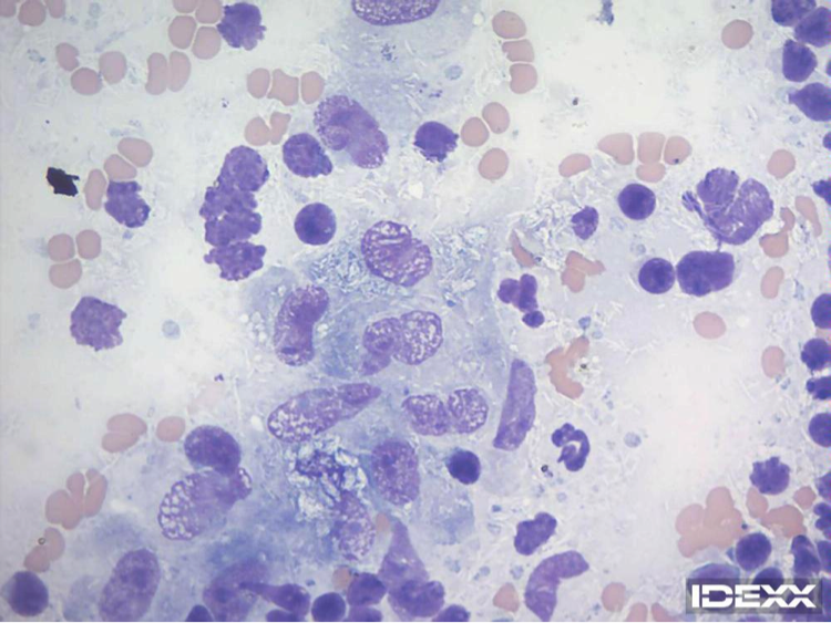 Figure 3. Lymph node cytology. 100x objective.