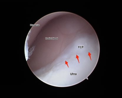 Understanding the Use of Arthroscopy in Dogs 