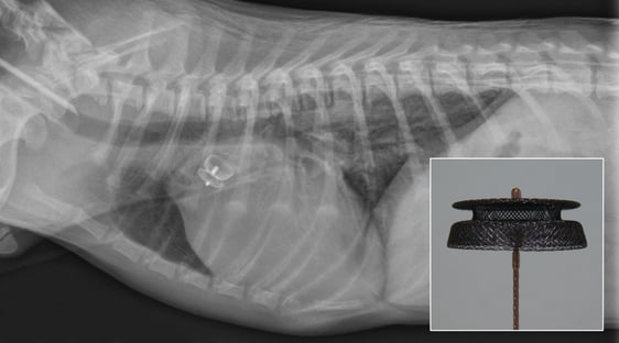 Figure 4: Post-procedure radiograph with appropriately positioned PDA occlusion device. The PDA occlusion device can be seen attached to the delivery cable (inset).