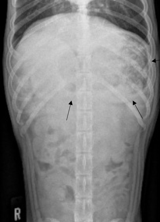 Figure 3. Ventrodorsal abdominal radiograph of a dog. Please see the black arrows that define the outer wall of the stomach. 