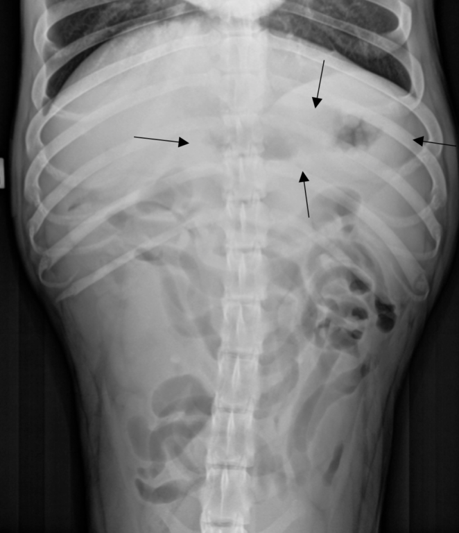 Figure 10. Ventrodorsal abdominal radiograph of a dog with ith a 2-day history of vomiting taken 14 hours after the radiograph identified in Figure 8. Black arrows define the outer wall of the stomach. The stomach is empty with a small amount of air. 