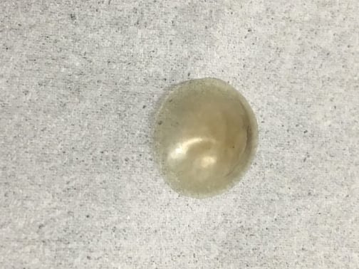 Figure 1.  Pigmented contact lens removed from a cat treated for a superficial ulcer.